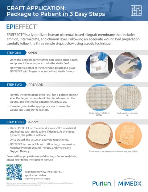 Epieffect Mimedx